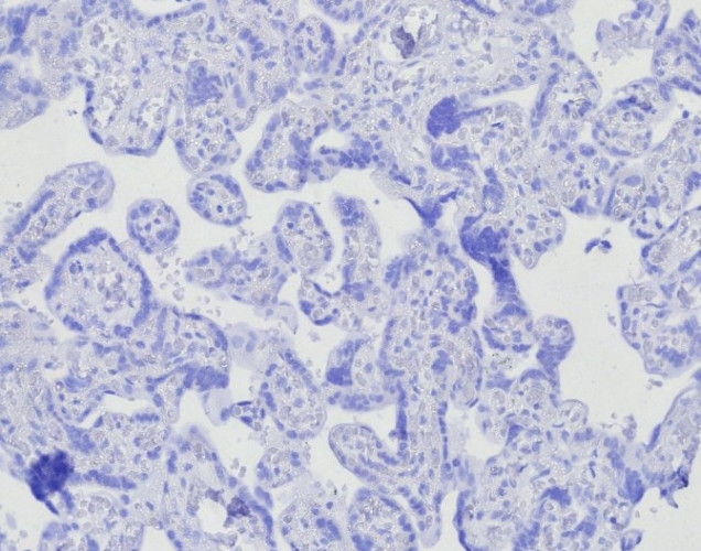 BOB.1 (B-Cell Marker) Antibody in Immunohistochemistry (Paraffin) (IHC (P))