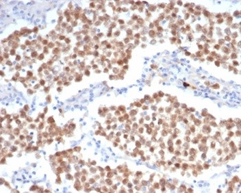 OCT-4 (POU5F1) (Germ Cell Tumor Marker) Antibody in Immunohistochemistry (Paraffin) (IHC (P))