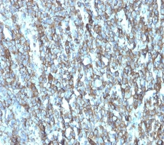 Migfilin-1/FBLIM1 Antibody in Immunohistochemistry (Paraffin) (IHC (P))