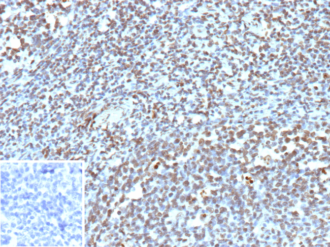 BCOR Antibody in Immunohistochemistry (Paraffin) (IHC (P))