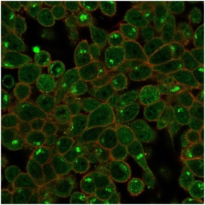 ZSCAN2 (Transcription Factor) Antibody in Immunocytochemistry (ICC/IF)