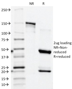 Prostate Specific Acid Phosphatase (PSAP) Antibody in SDS-PAGE (SDS-PAGE)