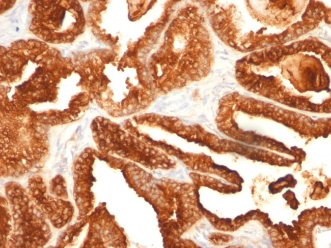 Prostate Specific Acid Phosphatase (PSAP) Antibody in Immunohistochemistry (Paraffin) (IHC (P))