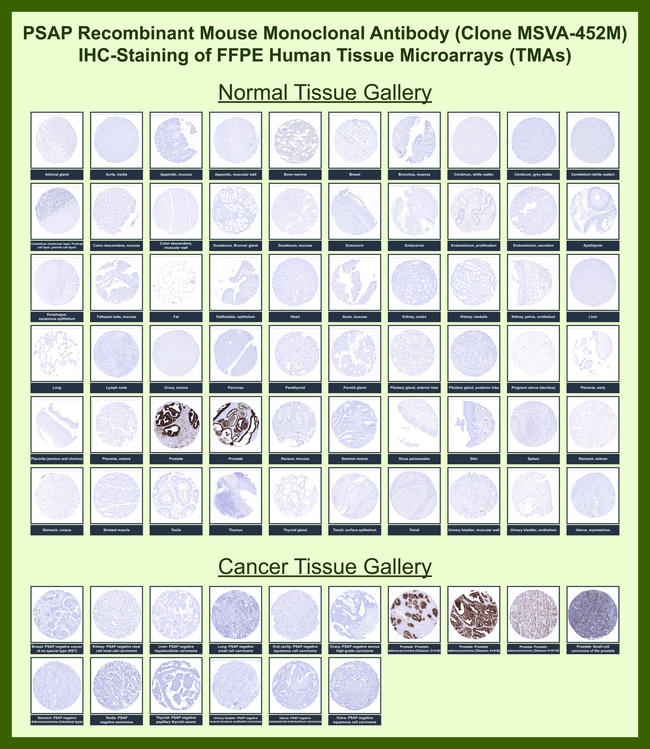 Prostate Specific Acid Phosphatase (PSAP) Antibody in Immunohistochemistry (Paraffin) (IHC (P))