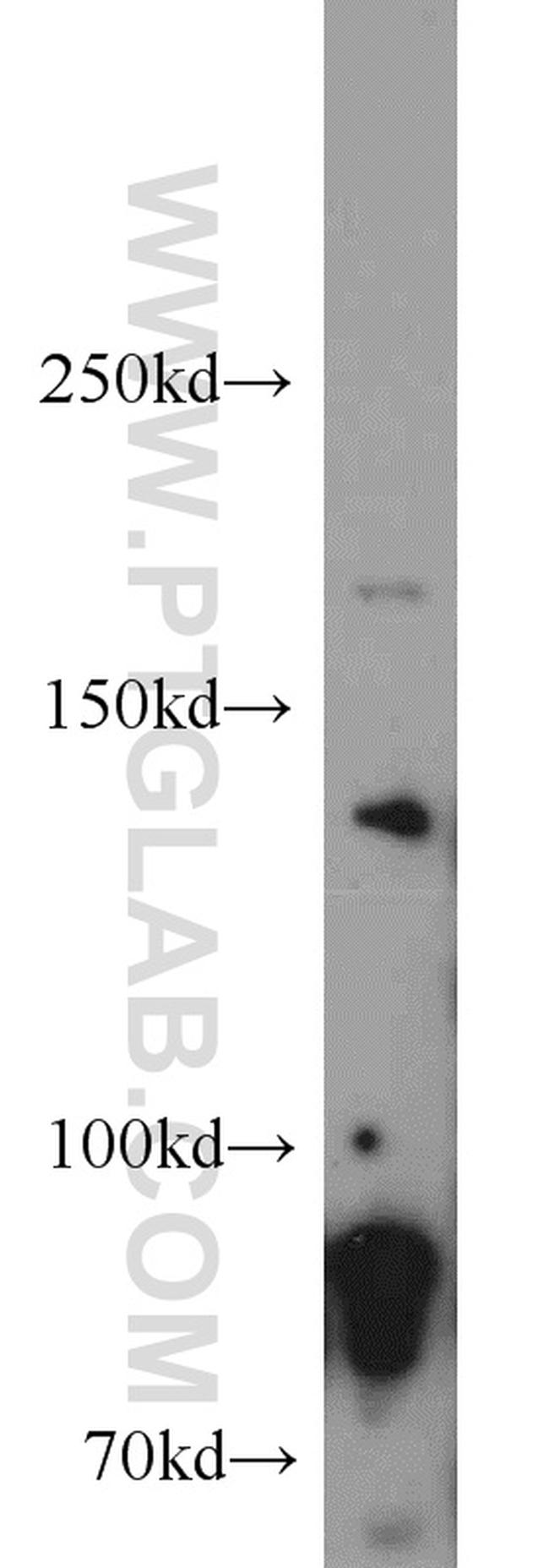 Drosha Antibody in Western Blot (WB)