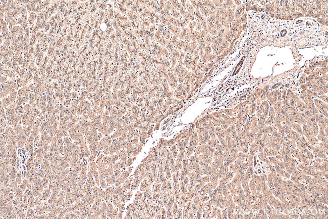 Cathepsin D Antibody in Immunohistochemistry (Paraffin) (IHC (P))