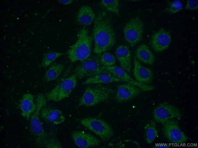 ELOVL4 Antibody in Immunocytochemistry (ICC/IF)