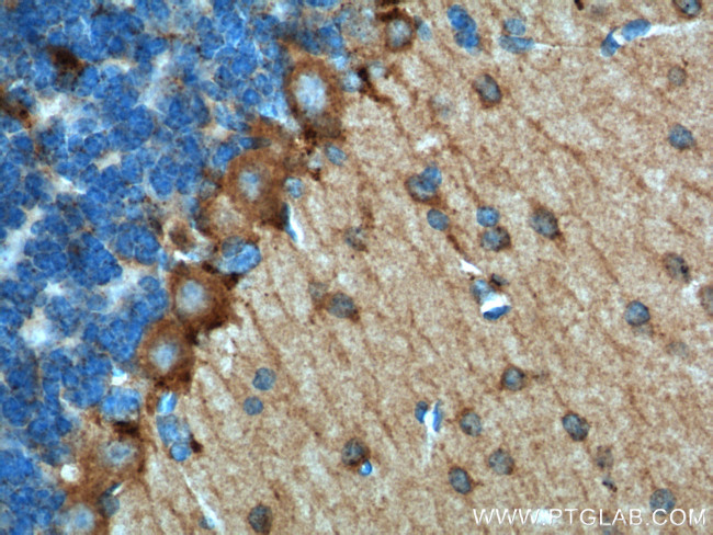 Adenosine A1 Receptor Antibody in Immunohistochemistry (Paraffin) (IHC (P))