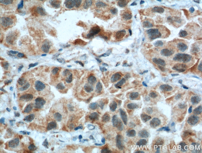CSPG4/NG2 Antibody in Immunohistochemistry (Paraffin) (IHC (P))
