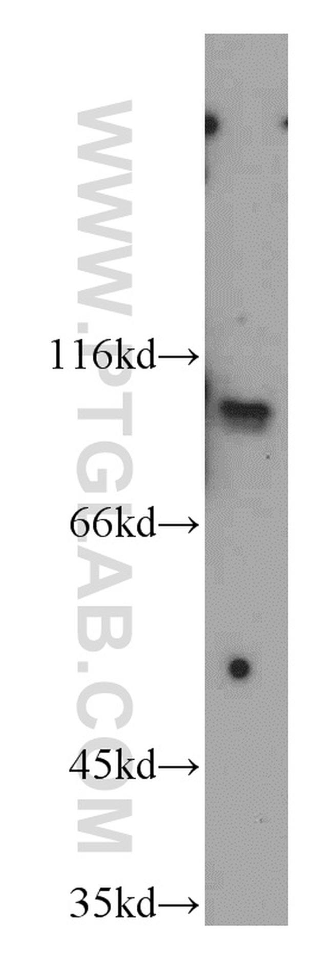 ELF1 Antibody in Western Blot (WB)