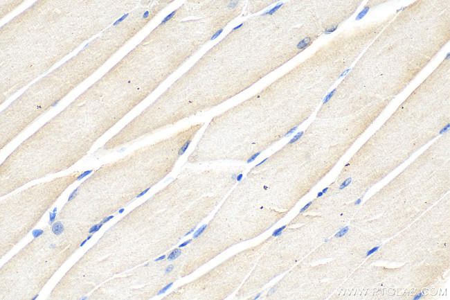 GBX1 Antibody in Immunohistochemistry (Paraffin) (IHC (P))