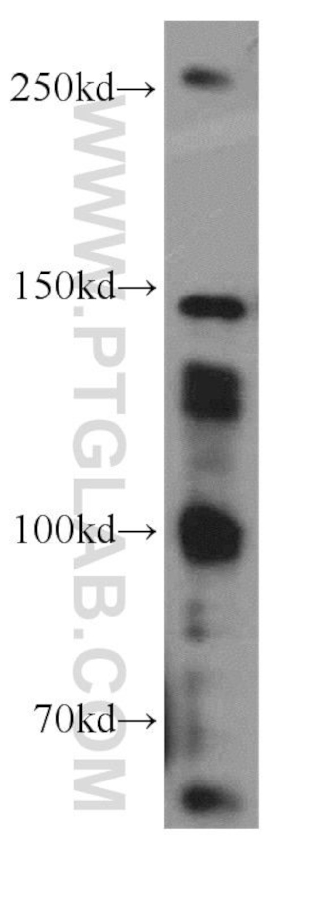 SOS1 Antibody in Western Blot (WB)