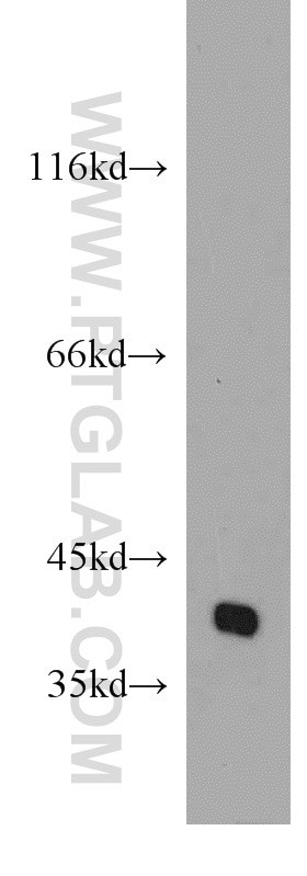 POU4F2 Antibody in Western Blot (WB)