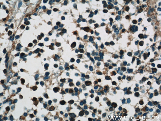 HuC Antibody in Immunohistochemistry (Paraffin) (IHC (P))