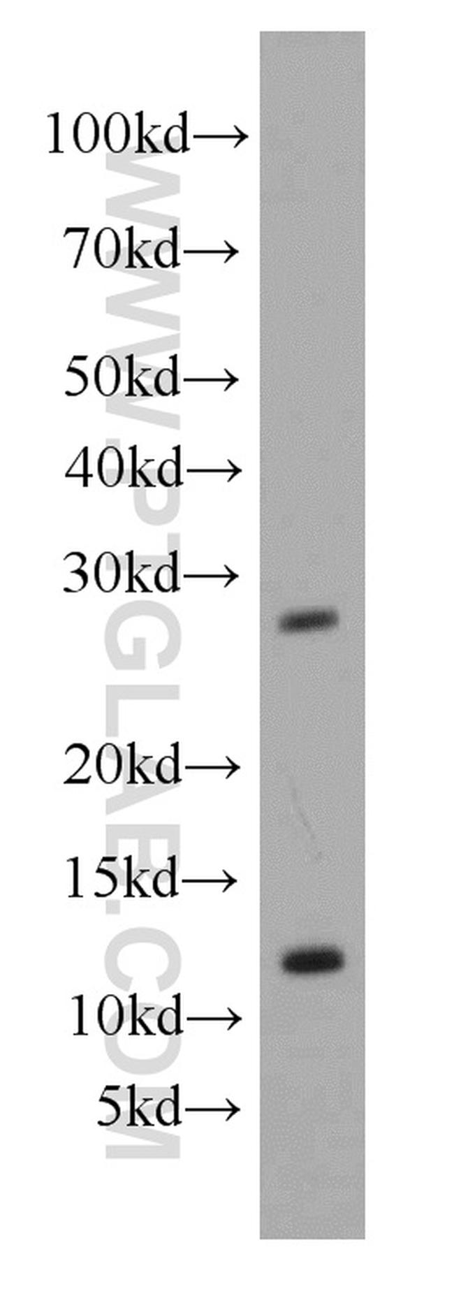 GSX1 Antibody in Western Blot (WB)