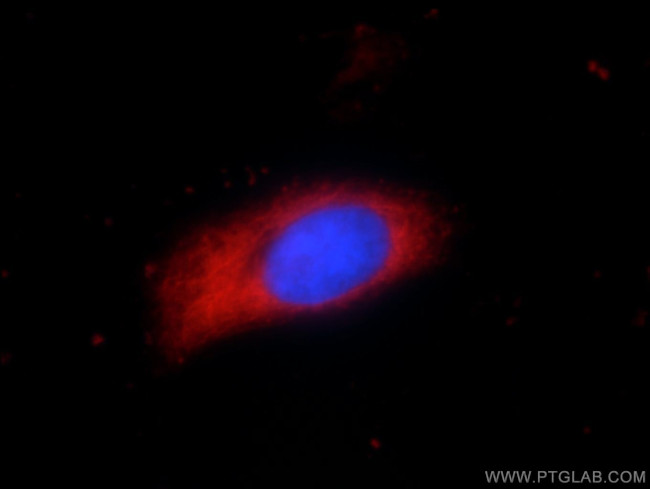 PYCR2 Antibody in Immunocytochemistry (ICC/IF)