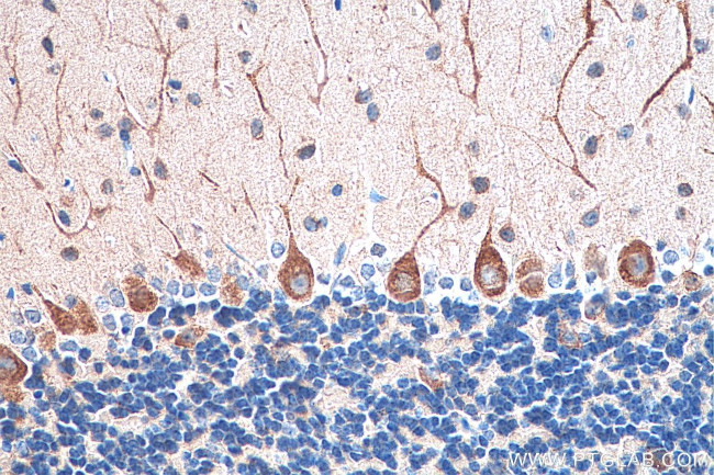 MAP1A Antibody in Immunohistochemistry (Paraffin) (IHC (P))