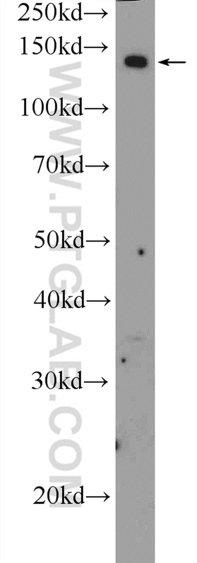 ADCY8 Antibody in Western Blot (WB)