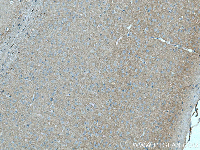 ADCY1 Antibody in Immunohistochemistry (Paraffin) (IHC (P))