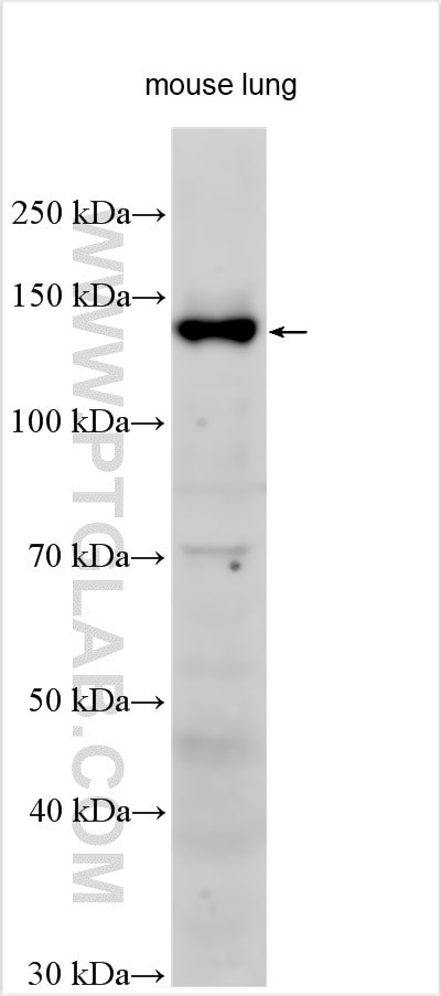 Integrin alpha-8 Antibody in Western Blot (WB)