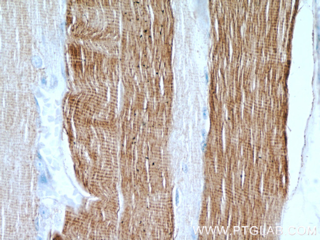 MYH2 Antibody in Immunohistochemistry (Paraffin) (IHC (P))