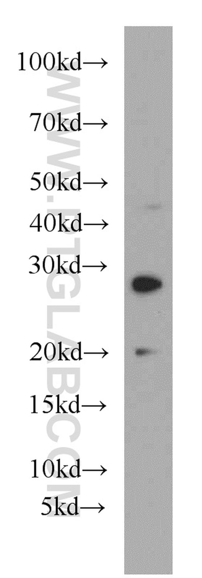 HLA-DQA2 Antibody in Western Blot (WB)