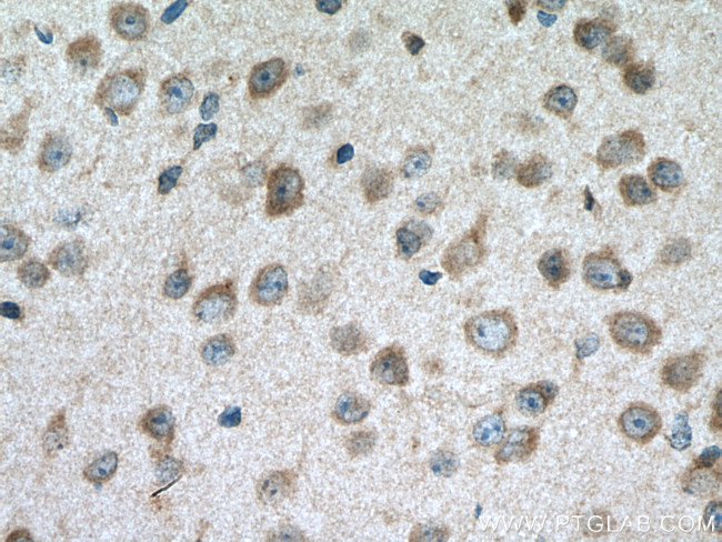 CACNG8 Antibody in Immunohistochemistry (Paraffin) (IHC (P))
