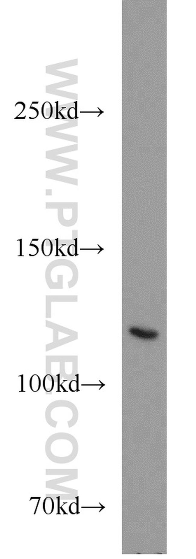DLG1 Antibody in Western Blot (WB)