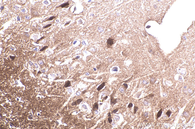 APBA1 Antibody in Immunohistochemistry (Paraffin) (IHC (P))