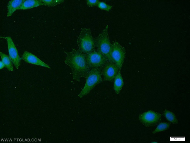 CYTB Antibody in Immunocytochemistry (ICC/IF)