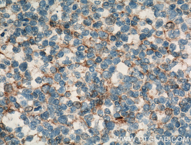CR1 Antibody in Immunohistochemistry (Paraffin) (IHC (P))
