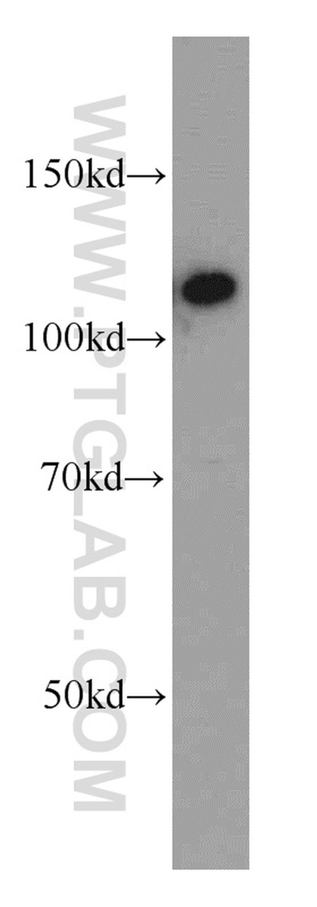 CIITA Antibody in Western Blot (WB)
