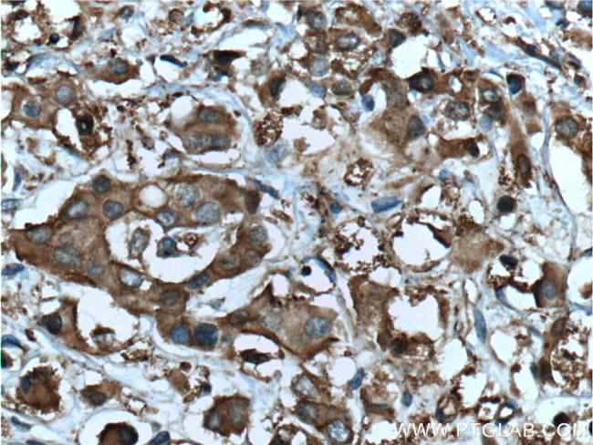 CDK3 Antibody in Immunohistochemistry (Paraffin) (IHC (P))
