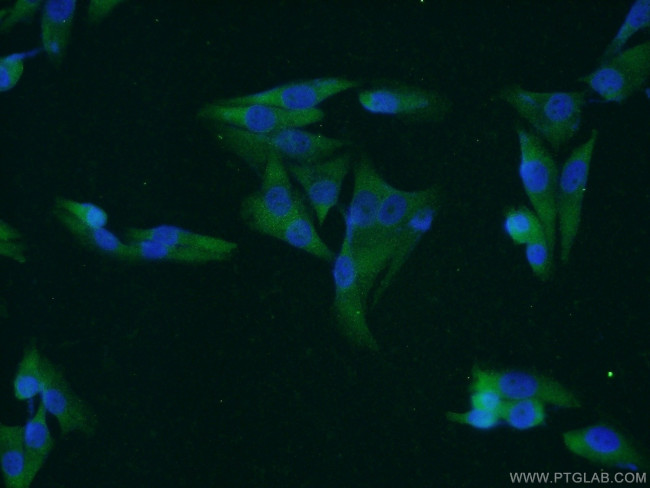 MAGEA1 Antibody in Immunocytochemistry (ICC/IF)