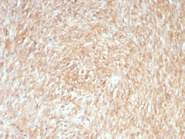 DOG-1/TMEM16A (Gastrointestinal Stromal Tumor Marker) Antibody in Immunohistochemistry (Paraffin) (IHC (P))