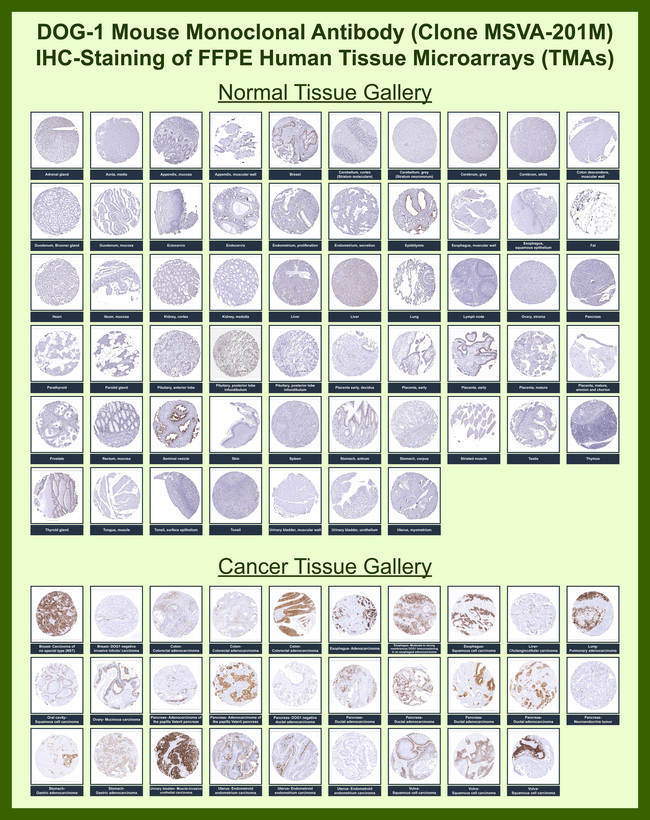 DOG-1/TMEM16A (Gastrointestinal Stromal Tumor Marker) Antibody in Immunohistochemistry (Paraffin) (IHC (P))