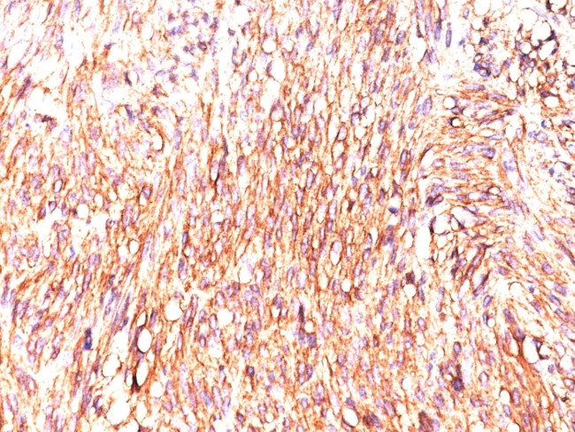 DOG-1/TMEM16A (Marker for Gastrointestinal Stromal Tumors) Antibody in Immunohistochemistry (Paraffin) (IHC (P))