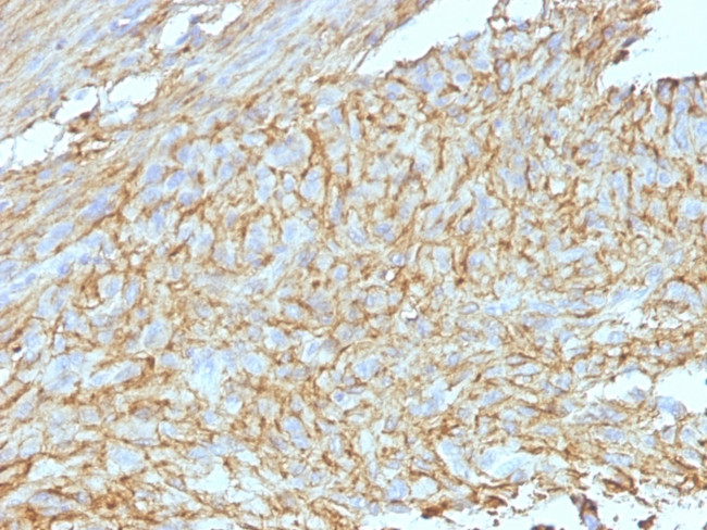 DOG-1/ANO1 (Marker for Gastrointestinal Stromal Tumors) Antibody in Immunohistochemistry (Paraffin) (IHC (P))