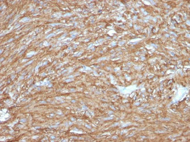 DOG-1/TMEM16A Antibody in Immunohistochemistry (Paraffin) (IHC (P))