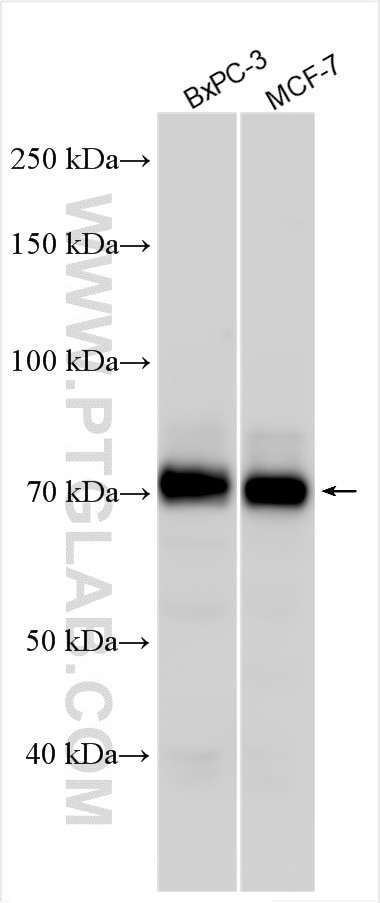 ATP13A3 Antibody in Western Blot (WB)