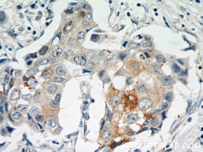 MAGEA4 Antibody in Immunohistochemistry (Paraffin) (IHC (P))