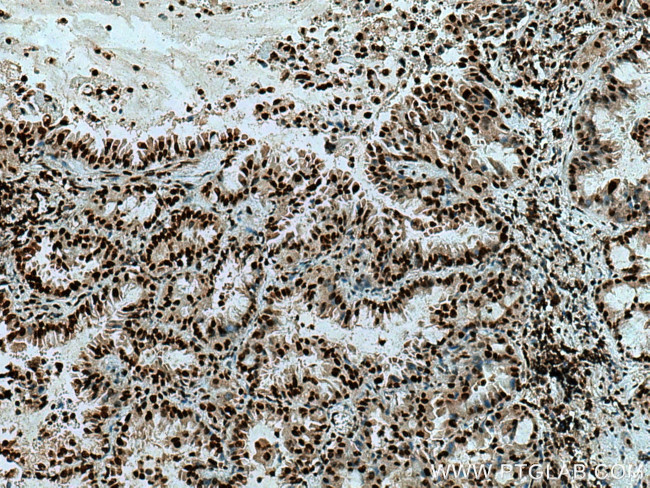 USP22 Antibody in Immunohistochemistry (Paraffin) (IHC (P))