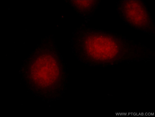 EGR1 Antibody in Immunocytochemistry (ICC/IF)