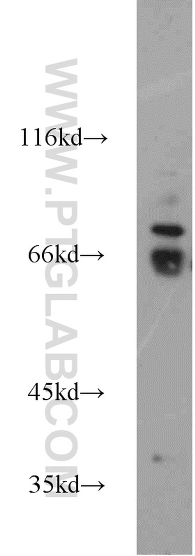 WEE2 Antibody in Western Blot (WB)