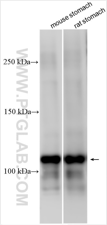 ATP4A Antibody in Western Blot (WB)