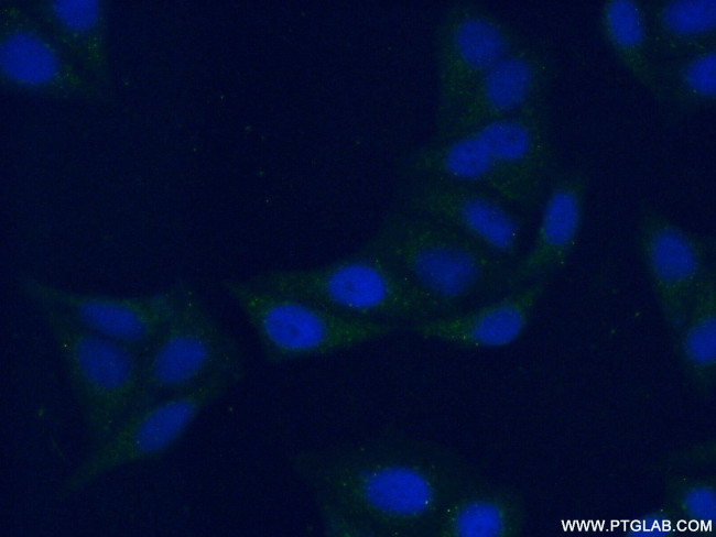 PSAPL1 Antibody in Immunocytochemistry (ICC/IF)