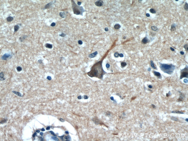 PPP1R9B Antibody in Immunohistochemistry (Paraffin) (IHC (P))
