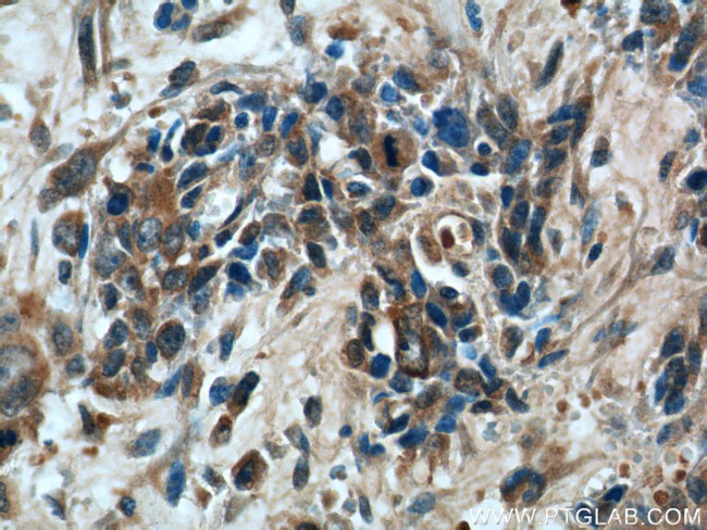 CAPZA1 Antibody in Immunohistochemistry (Paraffin) (IHC (P))