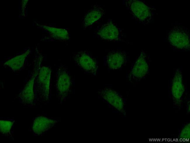 PARP2 Antibody in Immunocytochemistry (ICC/IF)