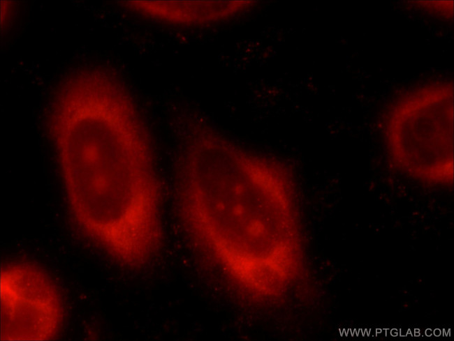 PPP1CC Antibody in Immunocytochemistry (ICC/IF)